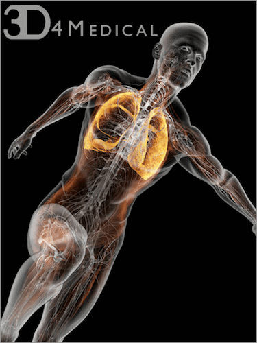 Anatomy III by 3D4Medical (Bundle)